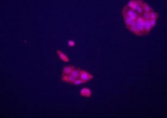 PAB4437 - Glypican-3 / GPC3