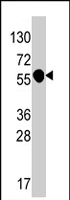 PAB4455 - IL1RL2 / IL1RRP2