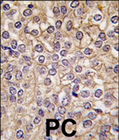 PAB4455 - IL1RL2 / IL1RRP2