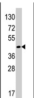 PAB4457 - RAD9A
