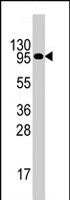 PAB4461 - CD131 / CSF2RB