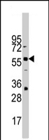 PAB4466 - ZBTB7B