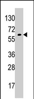 PAB4470 - Glypican-6 / GPC6