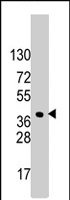 PAB4472 - HDGF