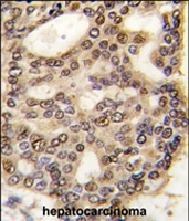 PAB4472 - HDGF