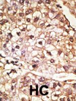 PAB4478 - Alpha-Synuclein / SNCA