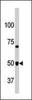 PAB4492 - GPR37 / PAEL Receptor