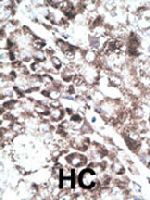 PAB4493 - GPR37 / PAEL Receptor