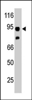 PAB4495 - Synphilin 1 / SNCAIP