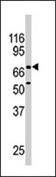 PAB4496 - NR4A2