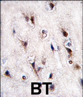 PAB4496 - NR4A2