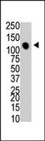 PAB4501 - MTMR4