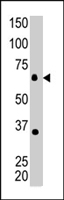 PAB4505 - MTMR8