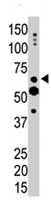 PAB4507 - Myotubularin / MTM1
