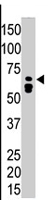 PAB4507 - Myotubularin / MTM1