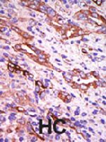 PAB4515 - Rhodopsin kinase