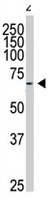 PAB4520 - GRK6