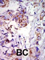 PAB4520 - GRK6