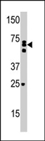 PAB4521 - RIOK2