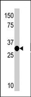 PAB4522 - RIOK2