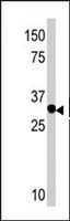 PAB4522 - RIOK2