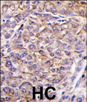 PAB4527 - TAO kinase 3 (TAOK3)