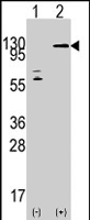 PAB4527 - TAO kinase 3 (TAOK3)