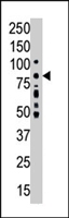 PAB4531 - PRKCA