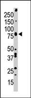 PAB4532 - PRKCB