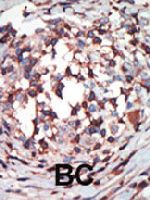 PAB4532 - PRKCB