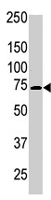 PAB4533 - PRKCB