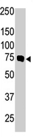 PAB4533 - PRKCB