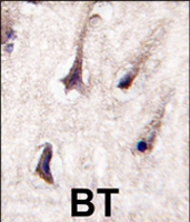PAB4533 - PRKCB