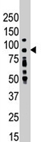 PAB4536 - PRKCD