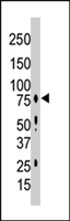 PAB4539 - PRKCG