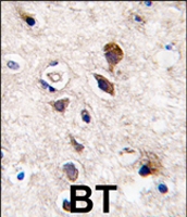 PAB4539 - PRKCG