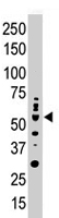 PAB4540 - PRKCI