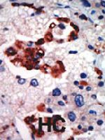 PAB4540 - PRKCI
