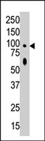 PAB4541 - PRKD1