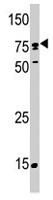 PAB4543 - SCYL2