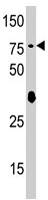 PAB4543 - SCYL2