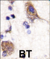 PAB4543 - SCYL2