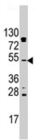 PAB4550 - AKT2 / PKB beta