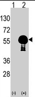 PAB4550 - AKT2 / PKB beta