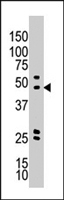 PAB4551 - AKT2 / PKB beta
