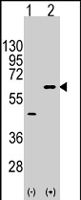 PAB4553 - AKT3 / PKB gamma