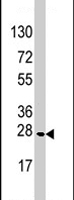 PAB4556 - MOB4A