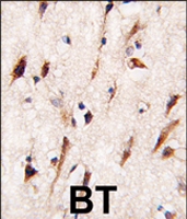 PAB4556 - MOB4A