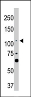 PAB4559 - LATS2