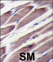 PAB4559 - LATS2